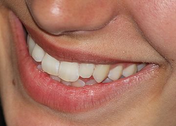 bezig Medisch wangedrag Hub Met je tanden in waterstofperoxide - NEMO Kennislink