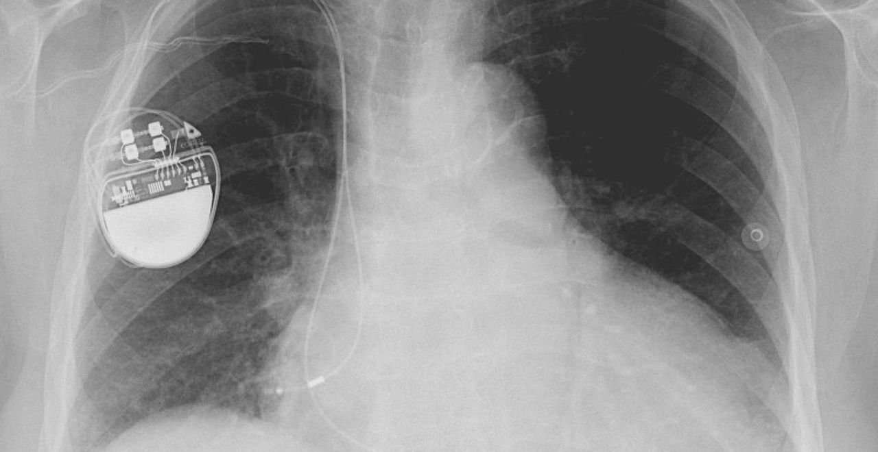 Biologische pacemaker - NEMO Kennislink